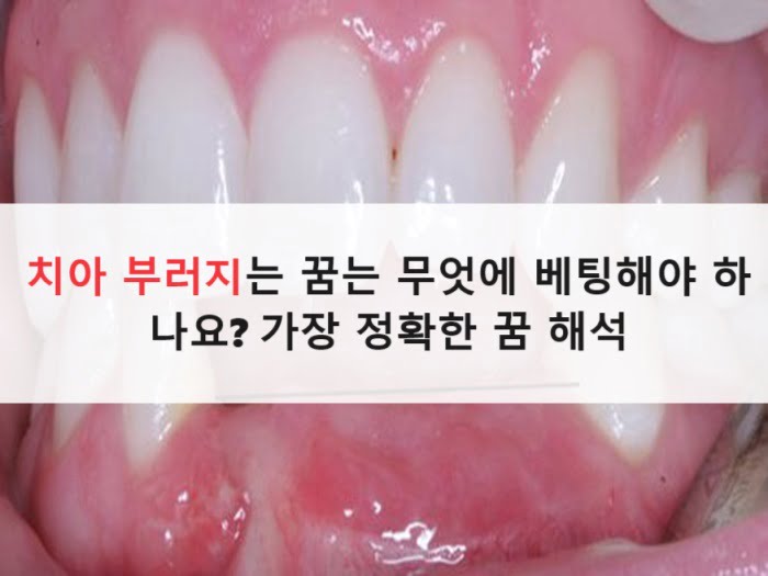 치아 부러지는 꿈는 무엇에 베팅해야 하나요? 가장 정확한 꿈 해석